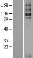 TGF beta Receptor III (TGFBR3) Human Over-expression Lysates NM_003243