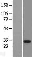 ls007050 tgif tgif1 human over expression lysates nm 173211 wb testing 9