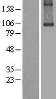 ls007051 tgm1 human over expression lysates nm 000359 wb testing 1
