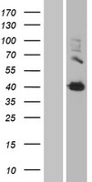 Transglutaminase 2 (TGM2) Human Over-expression Lysates NM_004613