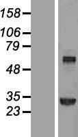 Transglutaminase 2 (TGM2) Human Over-expression Lysates NM_198951