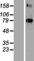 Transglutaminase 3 (TGM3) Human Over-expression Lysates NM_003245