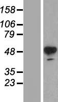 ls007054 tyrosine hydroxylase th human over expression lysates nm 000360 wb testing 1