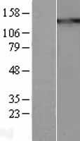 Thrombospondin 1 (THBS1) Human Over-expression Lysates NM_003246