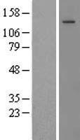 Thrombospondin 2 (THBS2) Human Over-expression Lysates NM_003247