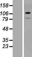 THBS3 Human Over-expression Lysates NM_007112