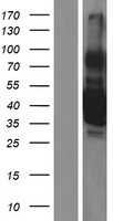ls007066 thrombopoietin thpo human over expression lysates nm 001177597 wb testing 1