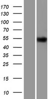 Thyroid Hormone Receptor alpha (THRA) Human Over-expression Lysates NM_003250