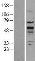Thyroid Hormone Receptor beta (THRB) Human Over-expression Lysates NM_000461