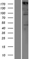 TIAM1 Human Over-expression Lysates NM_003253