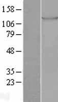 TIE1 Human Over-expression Lysates NM_005424