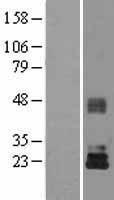 ls007078 timp3 human over expression lysates nm 000362 wb testing 1