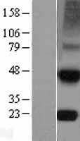 TIMP4 Human Over-expression Lysates NM_003256