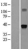 TTF1 (NKX2-1) Human Over-expression Lysates NM_003317