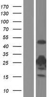 Thymidine Kinase 1 (TK1) Human Over-expression Lysates NM_003258