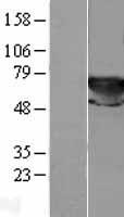 ls007086 transketolase tkt human over expression lysates nm 001064 wb testing 1