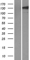 TLL1 Human Over-expression Lysates NM_012464