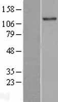ls007093 tll2 human over expression lysates nm 012465 wb testing 1