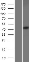 SEC62 Human Over-expression Lysates NM_003262