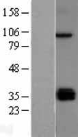 TLR5 Human Over-expression Lysates NM_003268