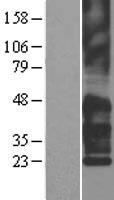 TM4SF2 (TSPAN7) Human Over-expression Lysates NM_004615