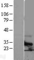 TSPAN6 Human Over-expression Lysates NM_003270