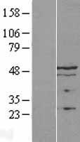 LAP2 (TMPO) Human Over-expression Lysates NM_001032283