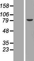 LAP2 (TMPO) Human Over-expression Lysates NM_003276