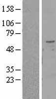 TMPRSS2 Human Over-expression Lysates NM_005656