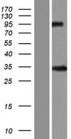 ls007122 claudin 5 cldn5 human over expression lysates nm 001130861 wb testing 1