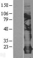 ls007122 claudin 5 cldn5 human over expression lysates nm 003277 wb testing 2