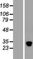 Tetranectin (CLEC3B) Human Over-expression Lysates NM_003278