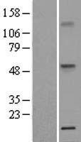 TNFRSF1A Human Over-expression Lysates NM_001065