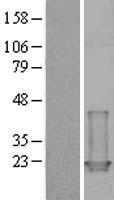 Cardiac Troponin I (TNNC1) Human Over-expression Lysates NM_003280