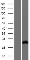 ls007136 troponin i fast skeletal muscle tnni2 human over expression lysates nm 001145841 wb testing 3