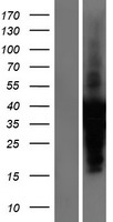 ls007137 cardiac troponin i tnni3 human over expression lysates nm 000363 wb testing 1