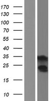 ls007138 troponin t1 tnnt1 human over expression lysates nm 001126133 wb testing 2