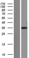 Cardiac Troponin T (TNNT2) Human Over-expression Lysates NM_001001430