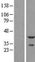 Cardiac Troponin T (TNNT2) Human Over-expression Lysates NM_001001431