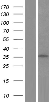 TNNT3 Human Over-expression Lysates NM_001042780