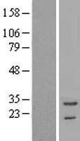 TNNT3 Human Over-expression Lysates NM_001042782