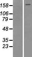 Topoisomerase II alpha (TOP2A) Human Over-expression Lysates NM_001067