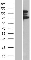 TP53BP2 Human Over-expression Lysates NM_001031685