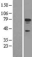 p73 (TP73) Human Over-expression Lysates NM_005427