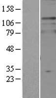 TPD52L2 Human Over-expression Lysates NM_003288