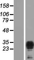 TPD52L2 Human Over-expression Lysates NM_199359