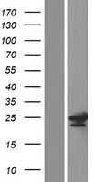 TPD52L2 Human Over-expression Lysates NM_199361