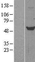 Tryptophan Hydroxylase (TPH1) Human Over-expression Lysates NM_004179