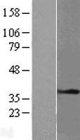ls007168 tpm1 human over expression lysates nm 001018020 wb testing 6