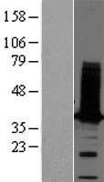 Tropomyosin 2 (TPM2) Human Over-expression Lysates NM_003289